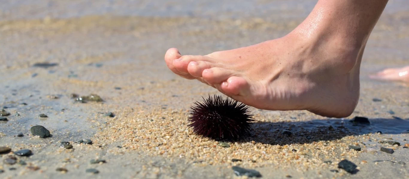 Προσοχή: Nα τι πρέπει να κάνετε αν πατήσετε αχινό